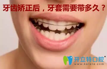 做完牙齒矯正后，保持器需要戴多長時間？看完你就明白了