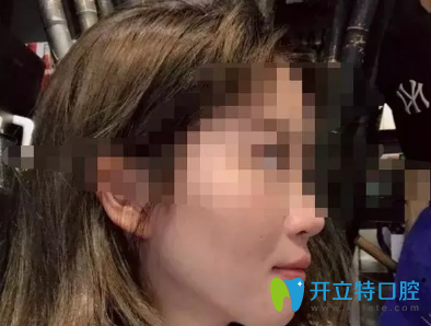 沒想到效果真的很好，我很感謝西安諾貝爾