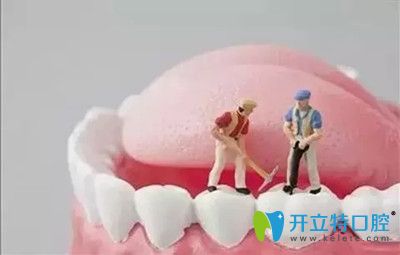 種植牙的壽命維持更長(zhǎng)時(shí)間的小竅門(mén)