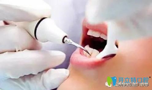云浮拜爾口腔微創(chuàng)無痛拔牙技術(shù) 云浮拜爾口腔微創(chuàng)無痛拔牙技術(shù)