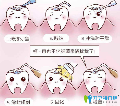 深度揭秘：窩溝封閉是個(gè)騙局?窩溝封閉后更容易爛牙？