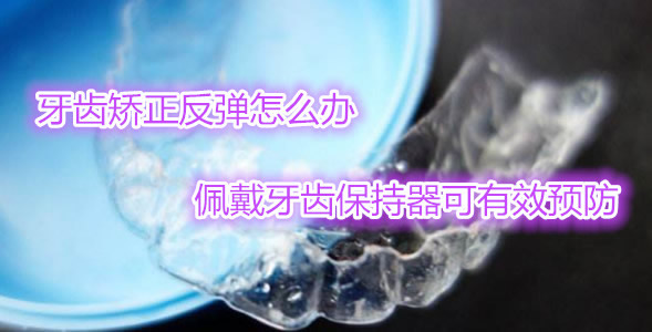 牙齒矯正一定要佩戴牙齒保持器嗎 保持器怎么清洗+注意事項(xiàng)