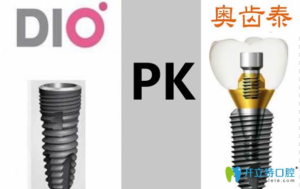 韓國dio和奧齒泰哪個好?兩者種植體的價格/壽命/材質大PK