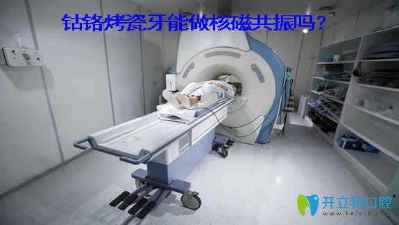 良心牙醫(yī)解析：鈷鉻烤瓷牙能做核磁共振嗎？