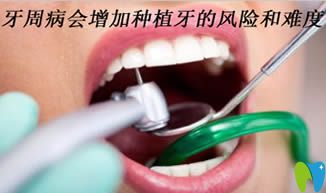 杭州植得口腔解析:牙周病為什么會增加種植牙的風(fēng)險和難度