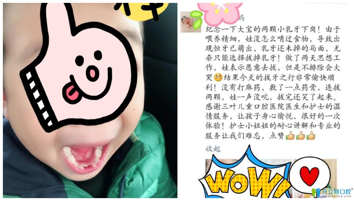孩子在三葉進(jìn)行治療后家長點(diǎn)評(píng)