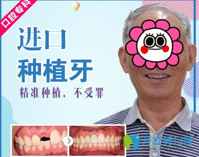 牙大夫與美奧口腔哪個(gè)好？美奧口腔種植牙案例來揭曉
