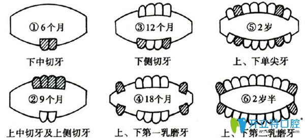 側(cè)切牙缺失怎么辦，有什么影響？