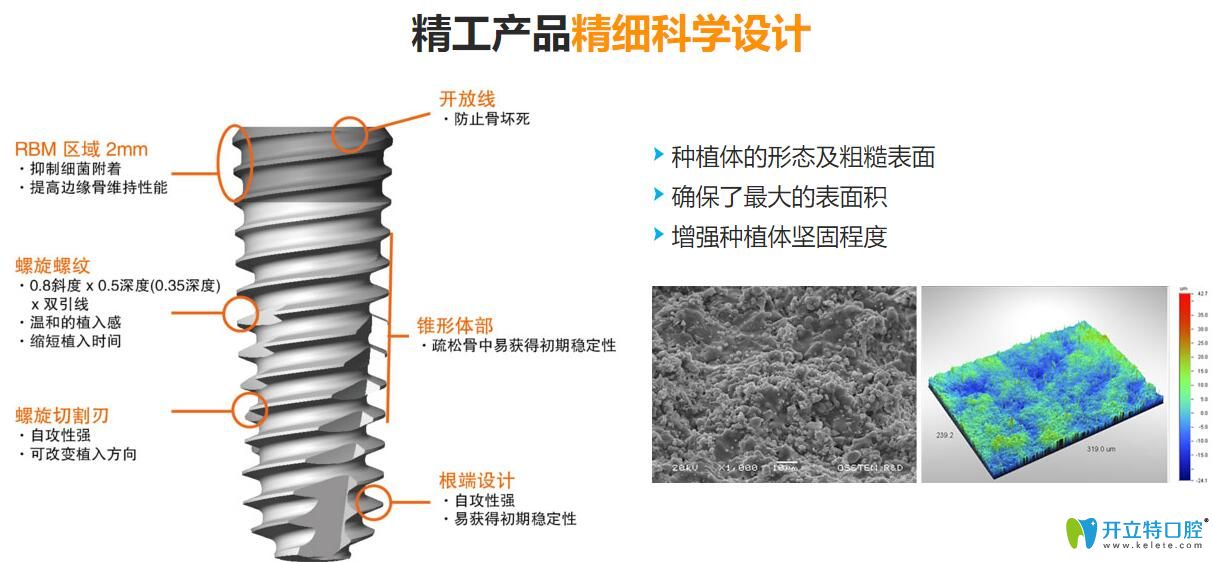 韓國種植牙質量怎么樣？韓國種植體價格為什么比較便宜？