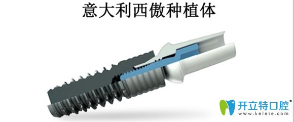 西傲種植體獨(dú)特的設(shè)計能減少牙槽骨的創(chuàng)傷