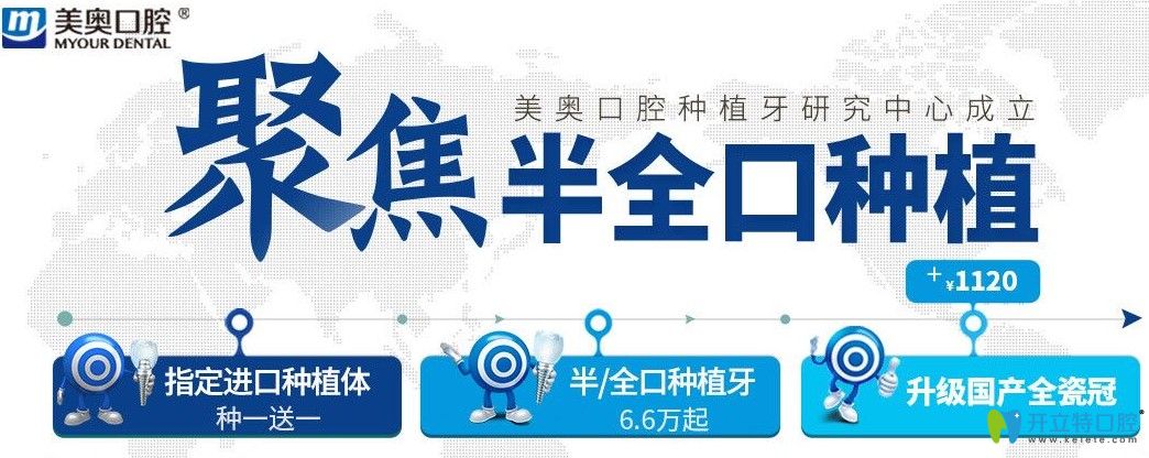 超劃算！杭州美奧口腔美國皓圣和法國安卓健都是種1送1吶