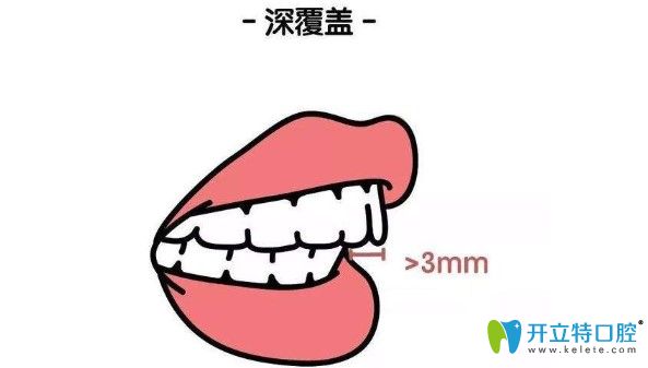 深覆蓋何不趁著康美做活動(dòng)矯正走起來