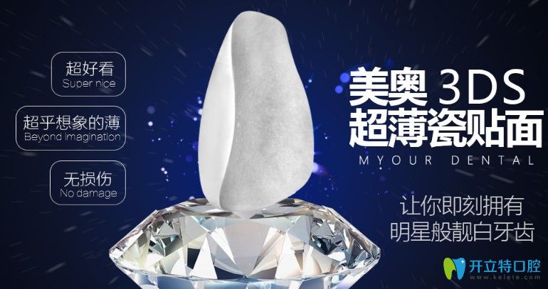 美奧口腔牙齒貼面價(jià)格