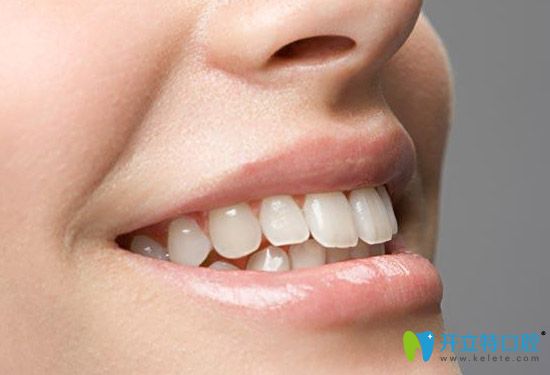 美萊口腔生態(tài)美容冠 美萊口腔生態(tài)美容冠