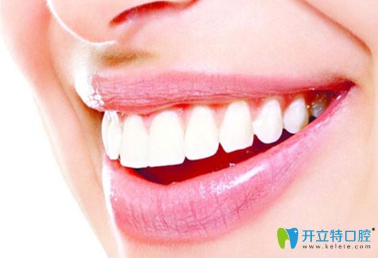 美萊口腔牙齒矯正后的樣子 美萊口腔牙齒矯正后的樣子