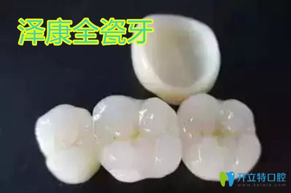 澤康全瓷牙多少錢?價格6000貴嗎?威蘭德和澤康哪個好了解下