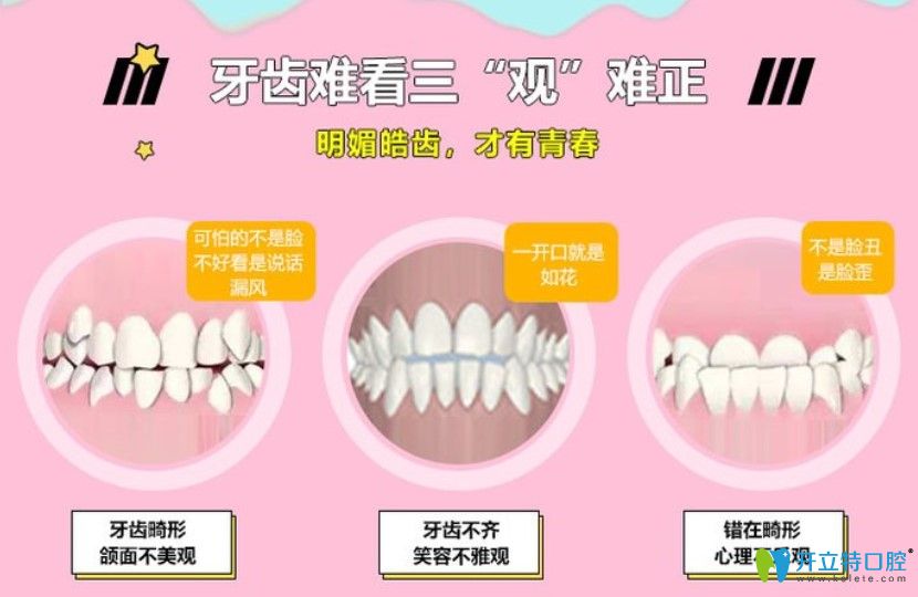 雙11來佳美口腔隱形矯正讓你不知不覺中變