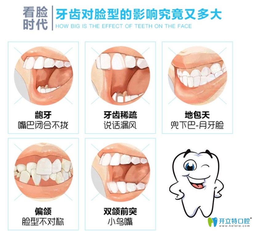 畸形的牙齒對(duì)臉型的影響