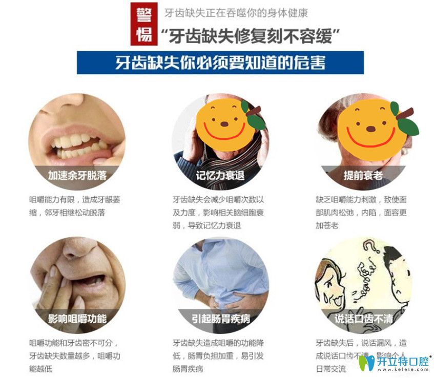 佳美口腔為缺牙父母獻禮種牙價格鉅惠來襲