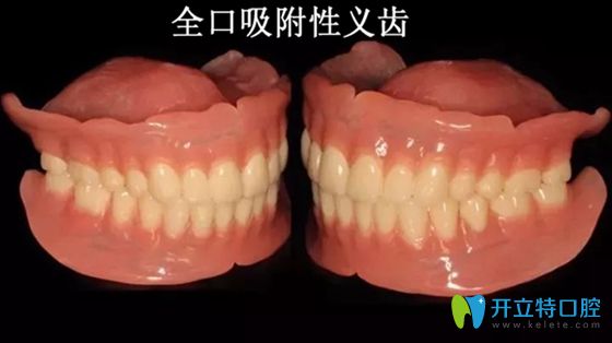 武漢仁愛(ài)口腔知識(shí)科普:吸附性義齒和普通義齒的區(qū)別及利弊