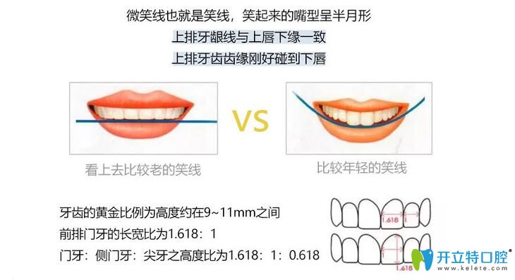 DSD美學(xué)微笑曲線設(shè)計(jì)圖