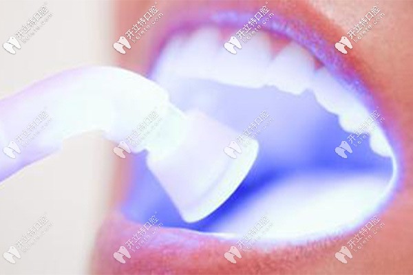 牙齒冷光美白儀器