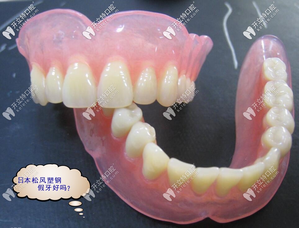 聽說日本松風(fēng)塑鋼牙假冒的很多,真假到底怎樣區(qū)別？