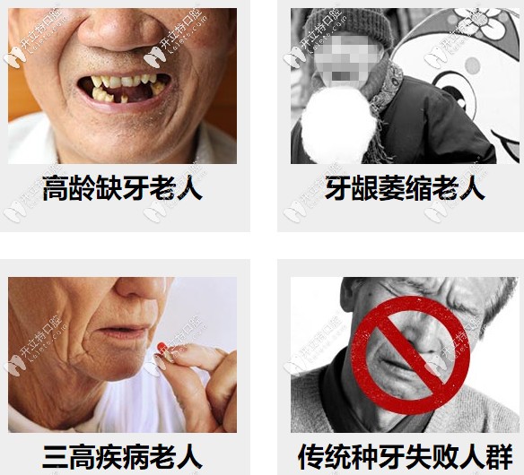 高齡缺牙、牙槽骨萎縮等都可以做種植牙