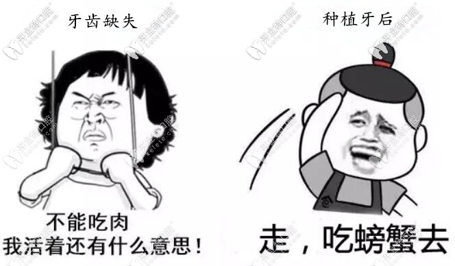 種植牙要使用一輩子,必須避開這4個(gè)坑選擇適合的種植體！