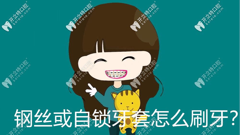 真捉急，剛戴牙套怎么刷牙啊