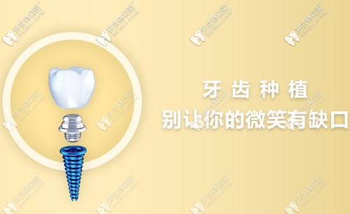 <!--<i data=20240703-sp></i>-->民尤其擅于微創(chuàng)種植手術(shù)