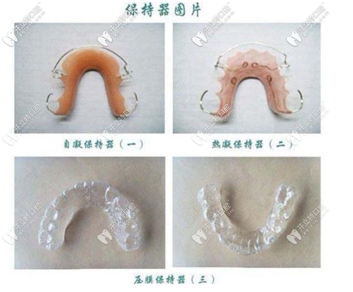 網(wǎng)上找的保持器圖片，我戴的是透明的保持器