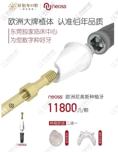 爆!東莞瑞典NEOSS親水種植體指定單位尼奧斯價(jià)格每顆直降8千