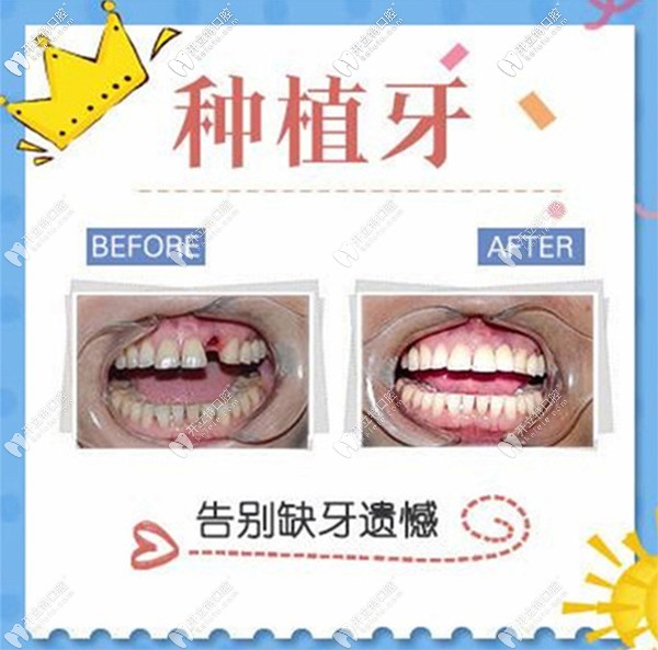 北京維嘉口腔價格表6家分店通用~遠大路店/通州萬達店