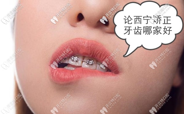 進來聊聊關于西寧市做牙齒矯正哪家牙科醫(yī)院好這個話題
