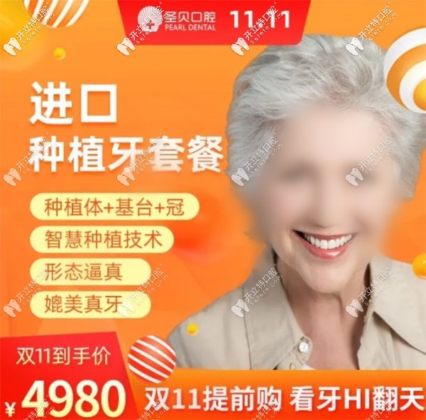 北京朝陽(yáng)圣貝做韓系進(jìn)口種植牙價(jià)位4980元起，雙11buy