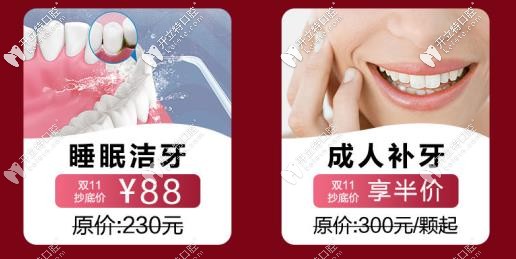 成人補(bǔ)牙、潔牙活動