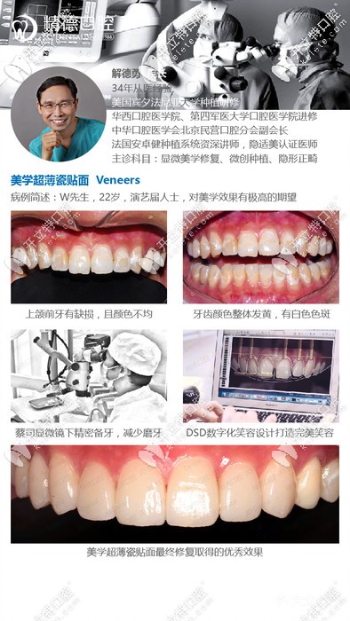 精德口腔解德勇院長(zhǎng)的牙齒貼面案例