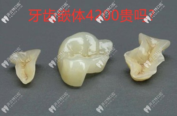 牙齒嵌體4200貴嗎?只能說嵌體補(bǔ)牙材質(zhì)不同價格也有差異哦