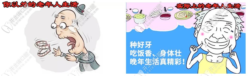老人掉了很多牙怎么辦？看58歲楊女士的種牙體驗