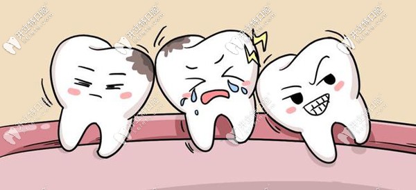 廈門(mén)登特口腔拔智齒多少錢(qián)？想知道登特和公立醫(yī)院比貴么