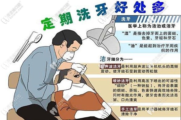 達州正規(guī)牙科醫(yī)院洗牙一般多少錢一次,收費價格你拿去