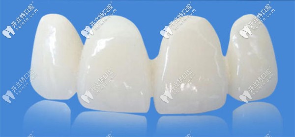 國產(chǎn)美晶瓷PK愛爾創(chuàng)全瓷牙哪個好？來看價格及優(yōu)缺點~