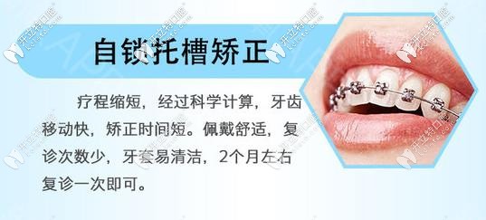國(guó)產(chǎn)指定金屬自鎖矯正器優(yōu)勢(shì)