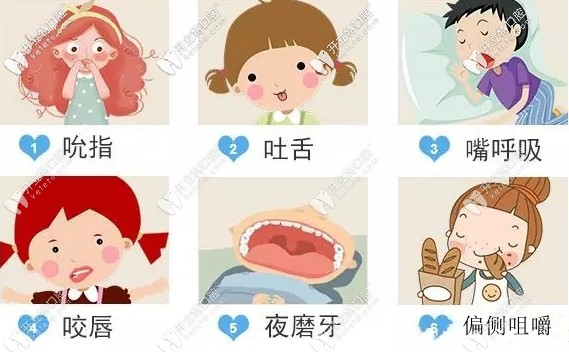 羅慕咬合矯正器多少錢一套？用過的來點評下價格和效果