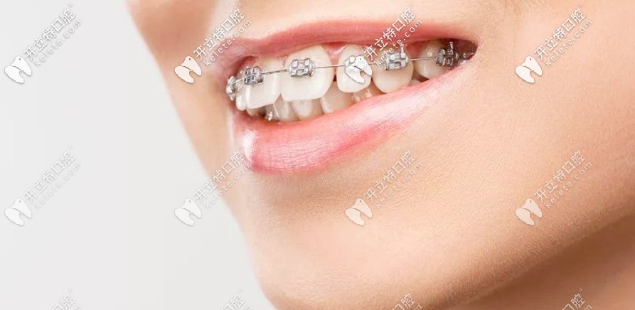 劇透南陽(yáng)口腔醫(yī)院收費(fèi)價(jià)格表，正畸和種牙費(fèi)用還不貴呢
