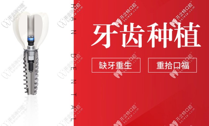 貴陽德韓口腔種植牙怎么樣？種牙技術(shù)好的醫(yī)生介紹奉上