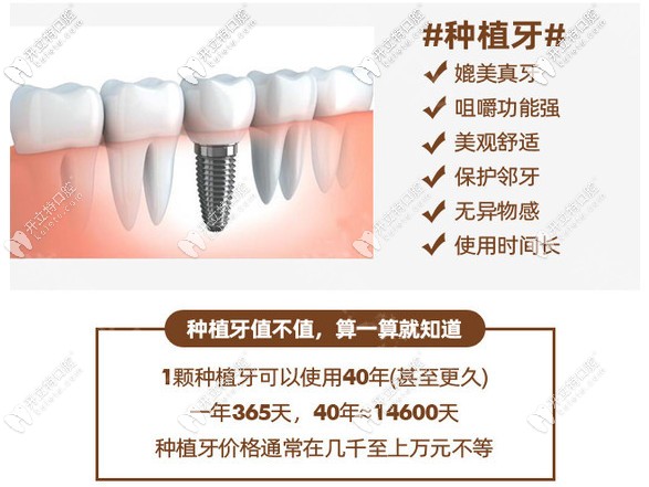 臨沂口腔醫(yī)院：種植牙的優(yōu)勢(shì)與使用壽命