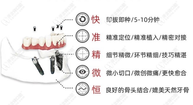 數(shù)字化微創(chuàng)種植牙特點