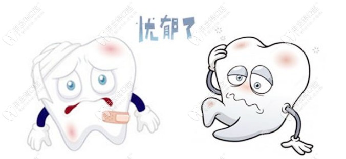 蛀洞太大補(bǔ)牙材料總掉該怎么辦？是時候了解長效補(bǔ)牙了